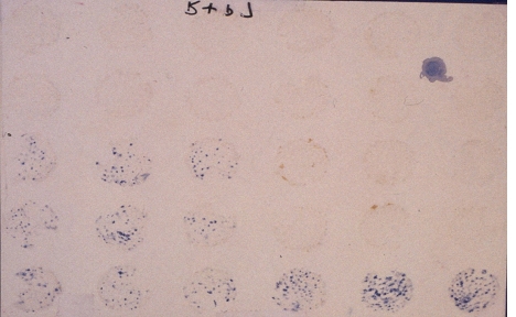 membrane blotted with stalk tissue cores