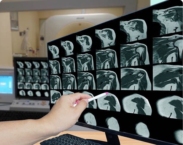 A person is using a stylus to point at detailed medical scans displayed on a computer monitor in a clinical setting. Description generated by AI
