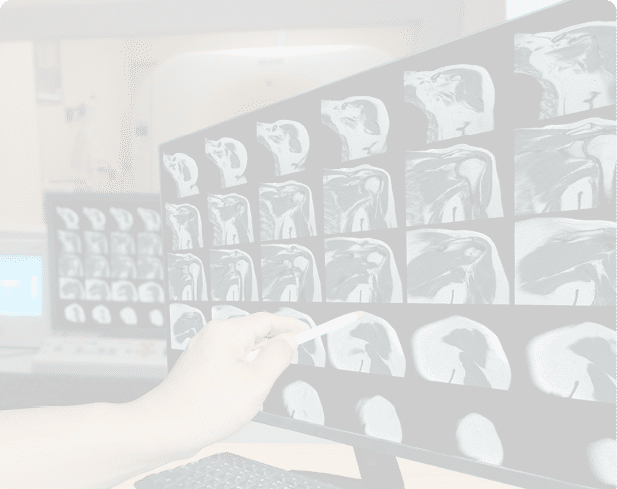 A person is using a stylus to point at detailed medical scans displayed on a computer monitor in a clinical setting. Description generated by AI
