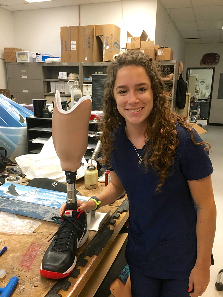 Emily Patterson posing with prosthetic leg