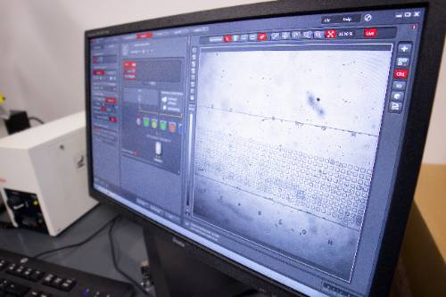 View of breast cancer cells on a computer screen