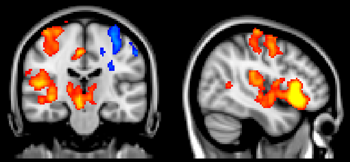 fMRI image