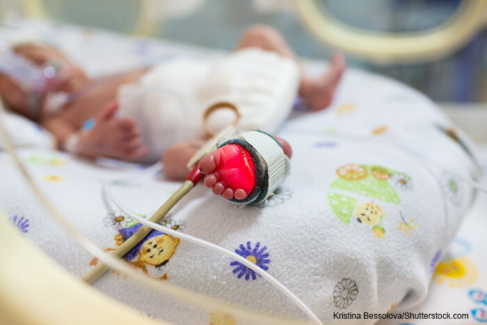 Premature infant in hospital bed with pulse monitor attached to foot.
