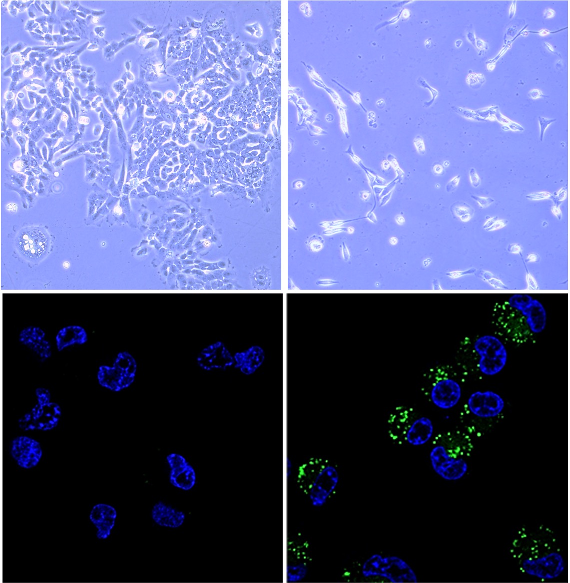 Rivas' lab cancer cells