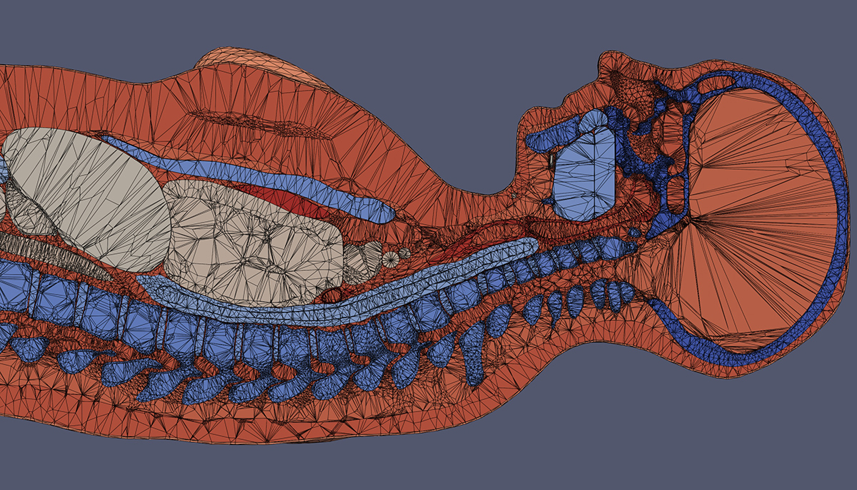 Human phantom, sagittal view